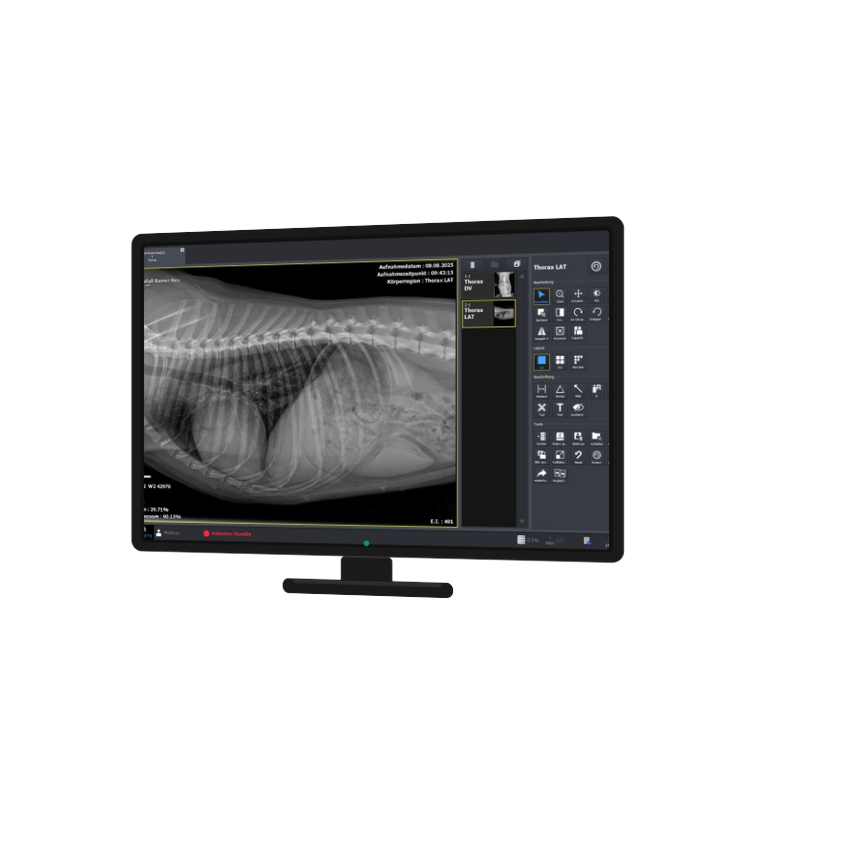 VXvue